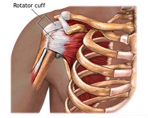 Rotator Cuff Disease